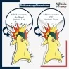 sticker sur plaque aluminium dibond ou panneau PVC Sticker Pokémon Typhlosion